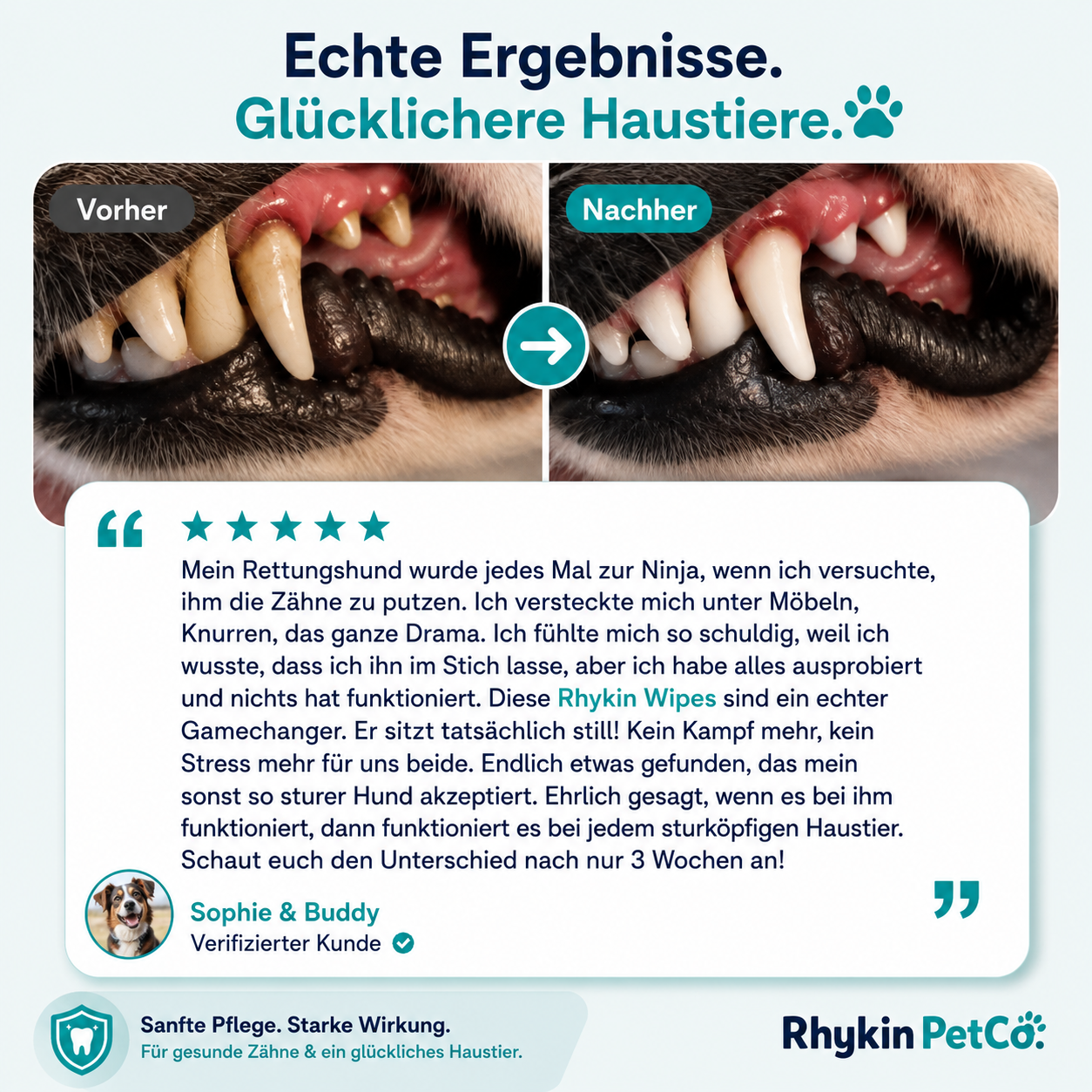 DentaWipe™ | Saubere Zähne ohne Kampf