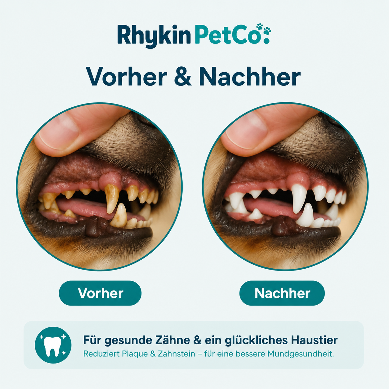DentaWipe™ | Saubere Zähne ohne Kampf